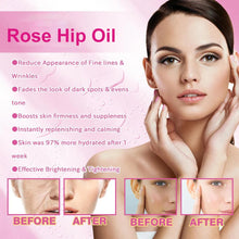 Load image into Gallery viewer, 100ml Natural Organic Rosehip Avocado Jojoba Coconut Tea Tree Vitamin E Oil Face Body Relaxing Moisturizing Hydrating Skincare Control Product