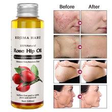 Load image into Gallery viewer, 100ml Natural Organic Rosehip Avocado Jojoba Coconut Tea Tree Vitamin E Oil Face Body Relaxing Moisturizing Hydrating Skincare Control Product