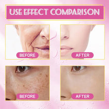 Load image into Gallery viewer, 100ml Natural Organic Rosehip Avocado Jojoba Coconut Tea Tree Vitamin E Oil Face Body Relaxing Moisturizing Hydrating Skincare Control Product